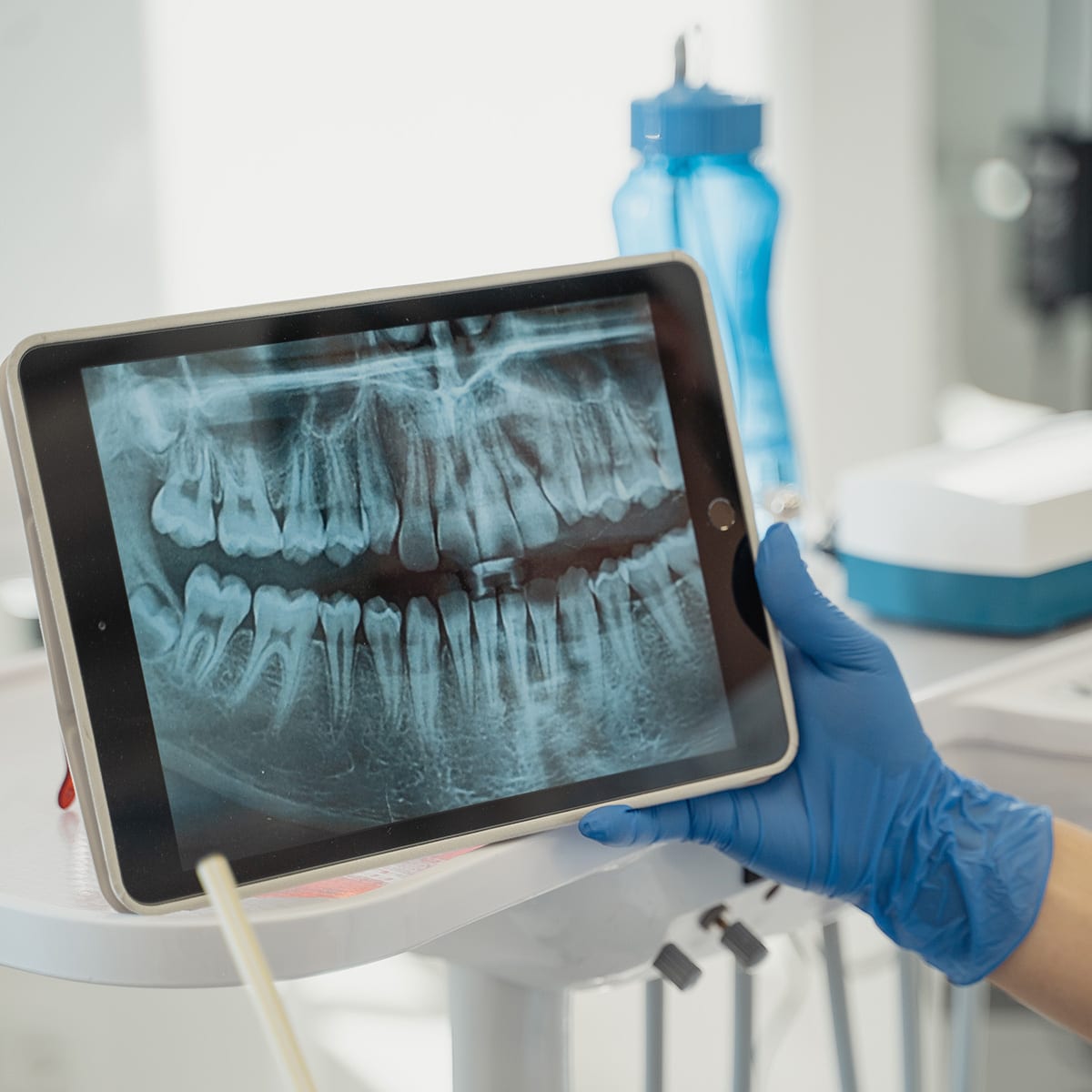 Modern Dental Technology - X-Ray Diagnostic Tablet